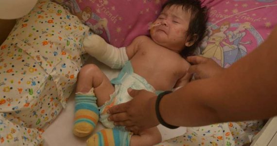 En Tupungato todos ayudan a la “Niña de Cristal”