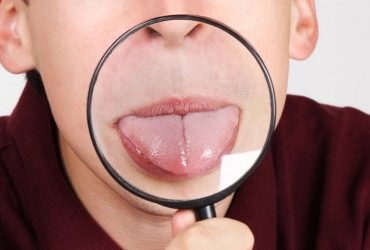 sacale la lengua al cancer